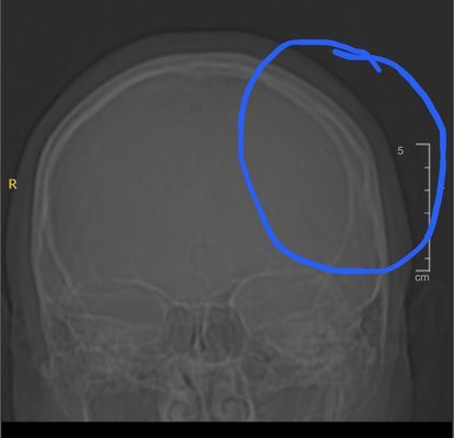 EvergreenHealth Urgent Care - Redmond