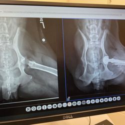 Total hip replacement