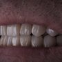 Buie Clinic- Advanced Dental Implants and Prosthetics