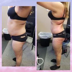 Total Image Master Body Sculpting