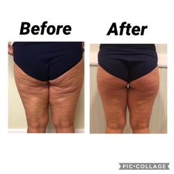 Bella Estetica Spa - Body contouring treatments