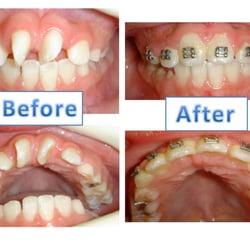 Hesham Amer, DDS, MSD - Treatment before & after