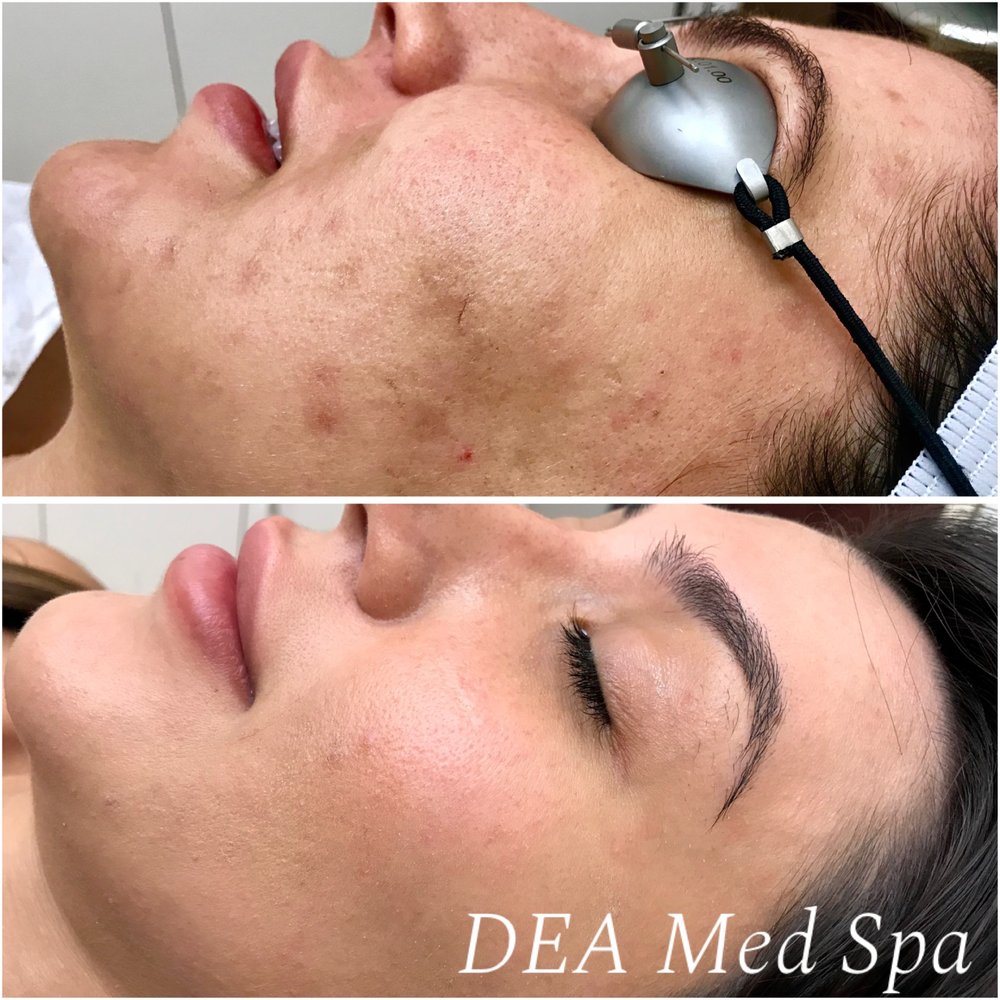 DEA Med Spa Logo
