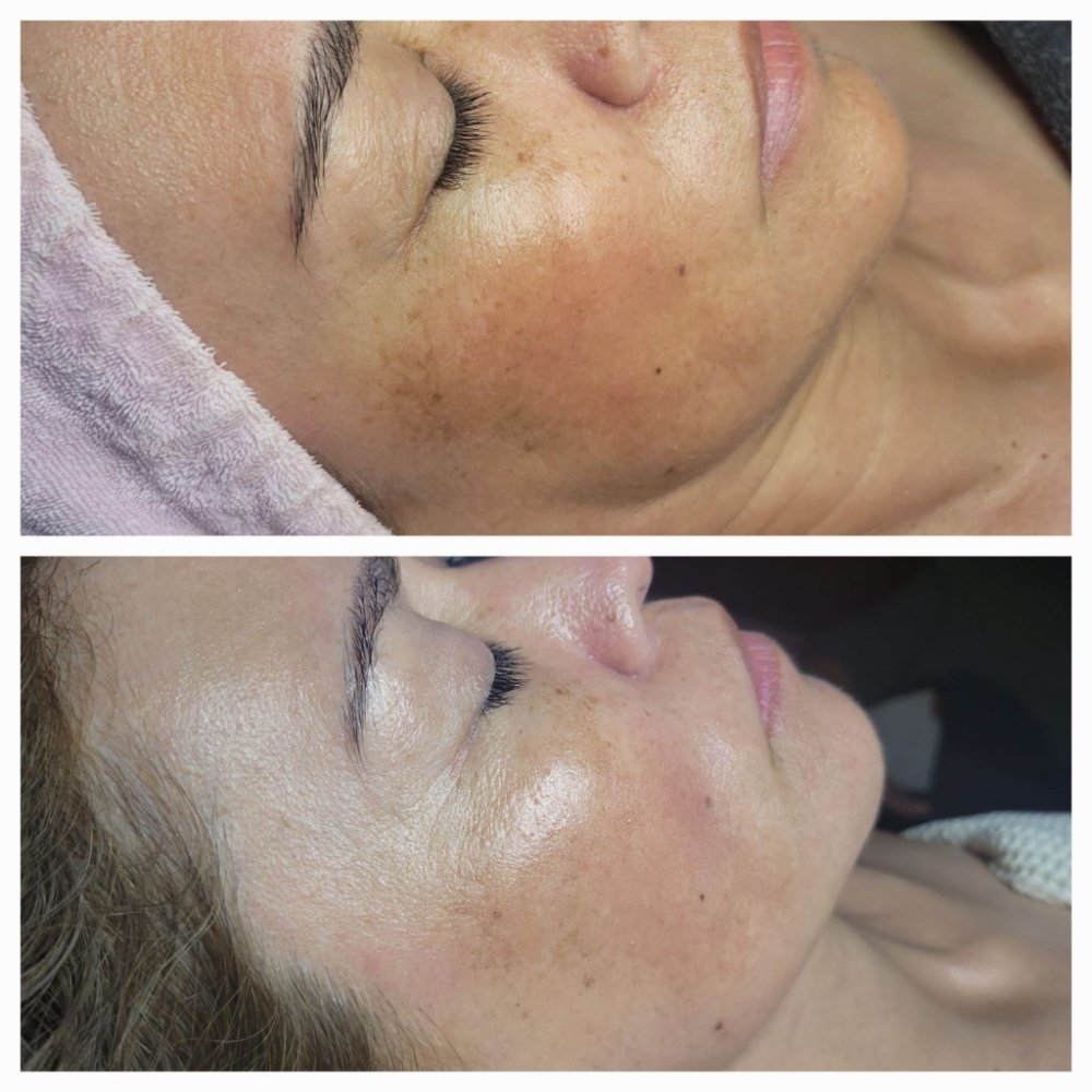 BEAUTY & BEYOND SKIN CARE CENTER 156 Photos & 302 Reviews 410 Sul