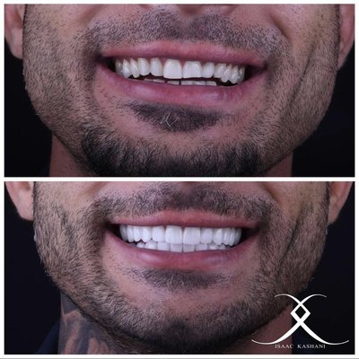 Our Photo Gallery Says It All - Have you seen our before and after photos? We create smile transformations daily, but no two are alike.