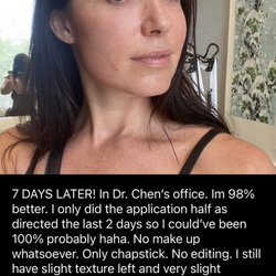 TCM Acupuncture - Pinecrest