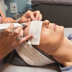 Calla Ink & Aesthetics - Skin Scrubber to get rid of congestion.