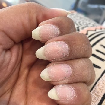 Vie Day Spa - Badly filed nails, after I was cut and started bleeding from the nail file I stopped with the service. - Nail Salons Near Me - Wildomar, California Vie Day Spa - Badly filed nails, after I was cut and started bleeding from the nail file I stopped with the service. - Nail Salons Near Me - Wildomar, California