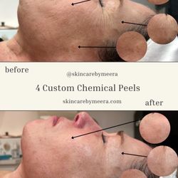 Skin Care by Meera