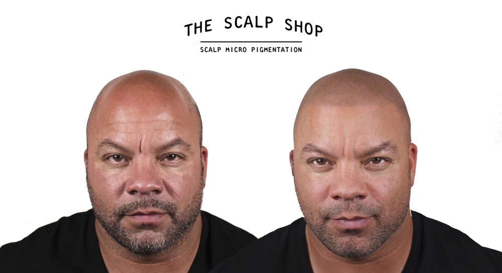 THE SCALP SHOP - 477 East 115th St, New York, New York - Hair Loss