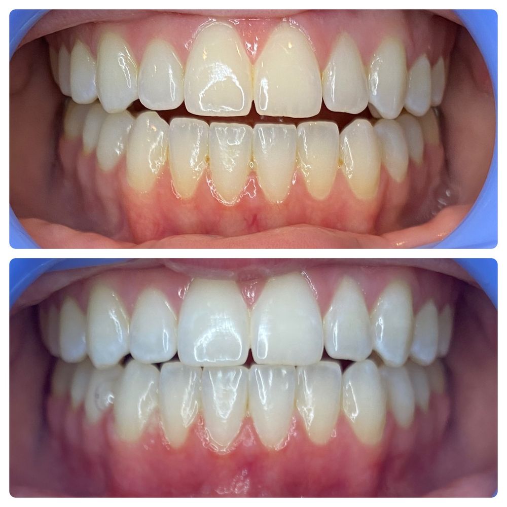Glow Up Teeth Whitening Logo