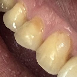 My bad tooth My bad tooth