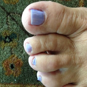 Supreme Nails - My pedicure by Christine. Picture taken as soon as I got home from Supreme Nails. Beware!!! - Nail Salons Near Me - Brick Township, New Jersey