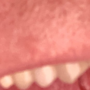 Serenity Dental Studio - One is the new implant. - General Dentistry Near Me - Gulf Shores, Alabama Serenity Dental Studio - One is the new implant. - General Dentistry Near Me - Gulf Shores, Alabama
