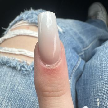 Star Nails - Santee - My nail 2 days later my nail is oozing liquid - Nail Salons Near Me - Santee, California Star Nails - Santee - My nail 2 days later my nail is oozing liquid - Nail Salons Near Me - Santee, California