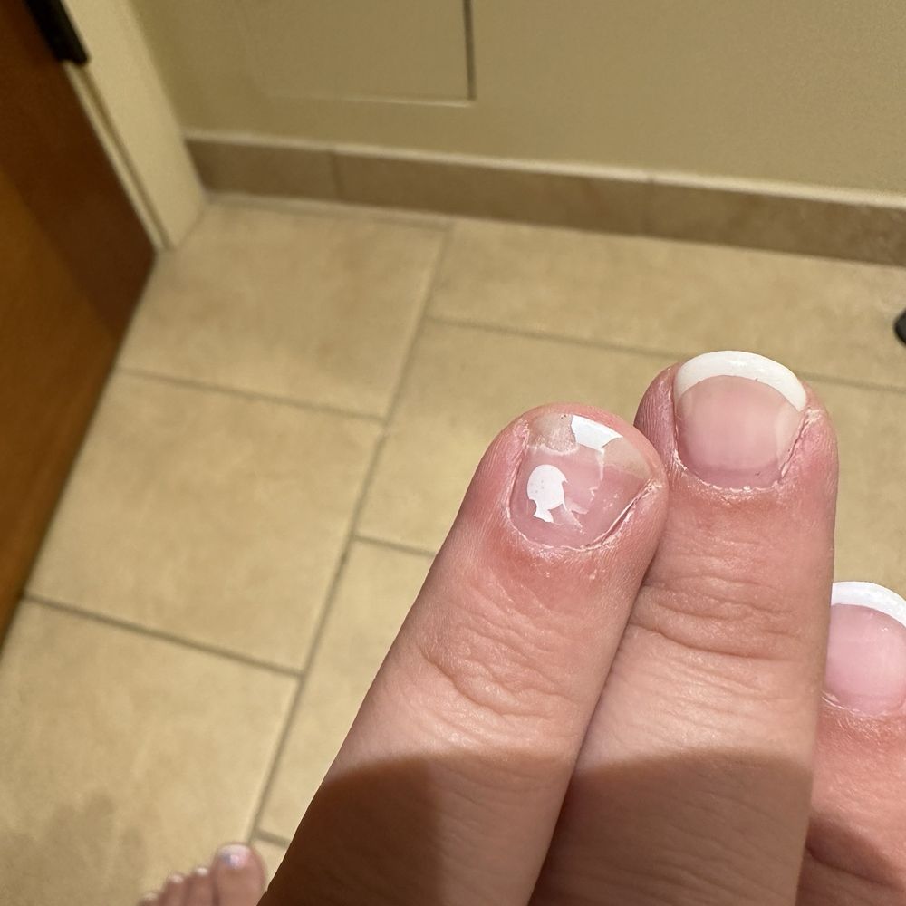 T Nails - Chipped GEL nails after 3 days - Nail Salons Near Me - Countryside, Illinois T Nails - Chipped GEL nails after 3 days - Nail Salons Near Me - Countryside, Illinois