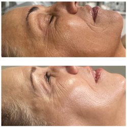 Trubeauty Esthetics