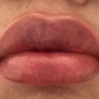 Glow Eyesthetics - Lips right after procedure - Eyelash Service Near Me - Huntington Beach, California