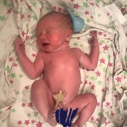 Francis Chang, MD - My beautiful, healthy boy ! Thank you Dr. Chang!
