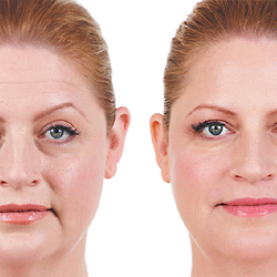 Richard M Foxx, MD - Leading San Diego office for providing a rested look to our patients.