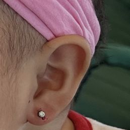 Infant piercing with upgraded titanium jewelry Infant piercing with upgraded titanium jewelry