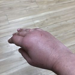 Accelerated Urgent Care - Only gave me antibiotics and told me to go to ER or buy over-the-counter medication for my pain.