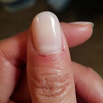 Red Polish - Clean job if it weren't for the two injuries. :( - Nail Salons Near Me - Los Angeles, California