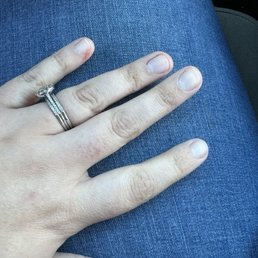 Bloody fingers Bloody fingers