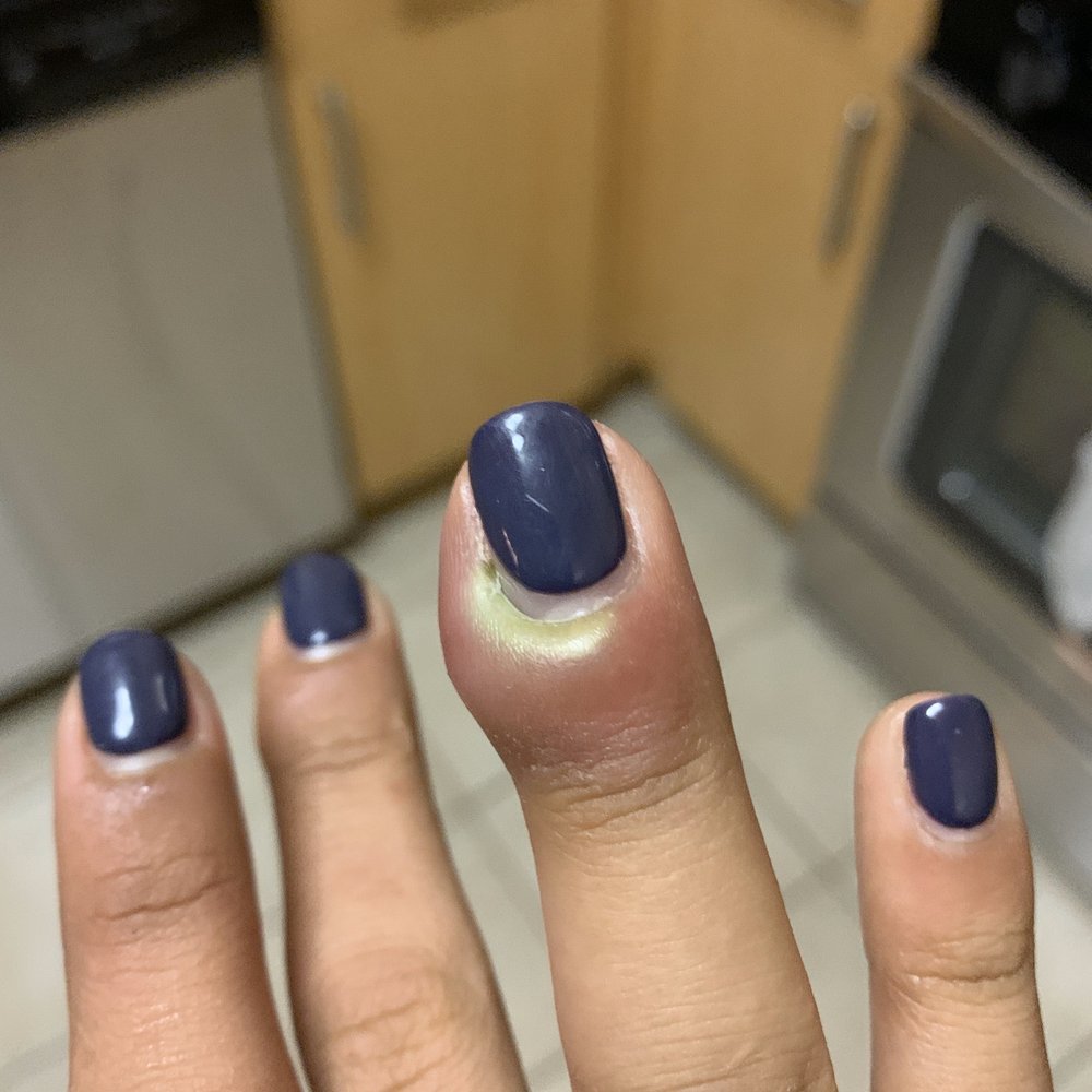 M54 Nails - Infection - Nail Salons Near Me - Washington, DC, District of Columbia M54 Nails - Infection - Nail Salons Near Me - Washington, DC, District of Columbia