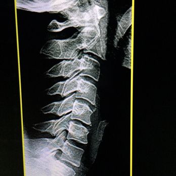 Gary Martin, DC - Chiropractors Near Me - Irvine, California Gary Martin, DC - Chiropractors Near Me - Irvine, California