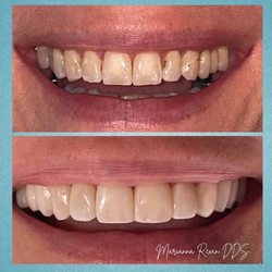 Union Fillmore Dental