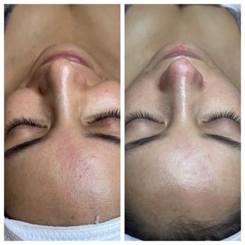 S V Cosmetology - Hydrating facial - Estheticians Near Me - Sherman Oaks, California S V Cosmetology - Hydrating facial - Estheticians Near Me - Sherman Oaks, California