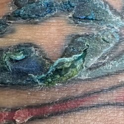 Baker Street Tattoo - Cracked and started to get infected