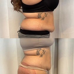 Beauty And Bella - Before & After