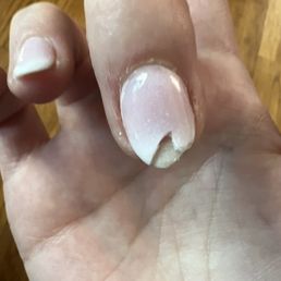 Chipped less than 2 weeks later!! Chipped less than 2 weeks later!!