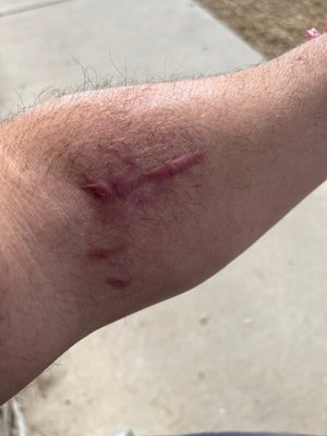 Orthoone Trauma at Swedish Medical Center