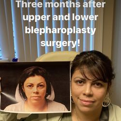 Mitesh Kapadia, MD PhD - I had both upper and lower done by Dr Kapadia.  If you have been looking for the best, look no further! I wish I had done it sooner.