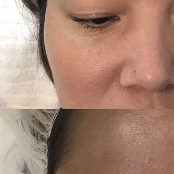 Pradna Brows & Beauty Bar - Micro-blading Miracle! - Medical Spas Near Me - Orlando, Florida Pradna Brows & Beauty Bar - Micro-blading Miracle! - Medical Spas Near Me - Orlando, Florida