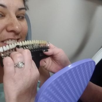 AZ Teeth Whitening Spa - To shade S12 - Teeth Whitening Near Me - Phoenix, Arizona