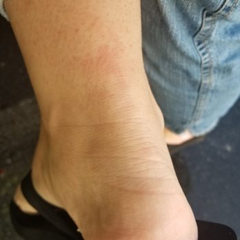 Annie Nails - Toe nails are painfully shrort, I have a cut on the top of my foot and scrapes on the back of my heel. Recept to prove. - Nail Salons Near Me - South Glens Falls, New York Annie Nails - Toe nails are painfully shrort, I have a cut on the top of my foot and scrapes on the back of my heel. Recept to prove. - Nail Salons Near Me - South Glens Falls, New York