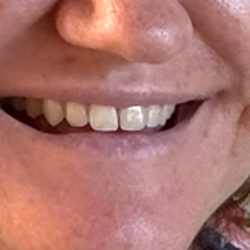 Sepi Pejham, DDS - After
