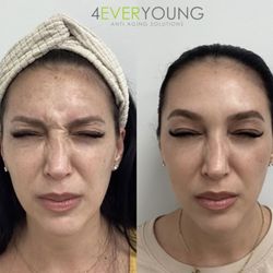 4Ever Young Med Spa & Wellness Center - Ridgewood - Our comprehensive consultations lead to results that can be seen and felt