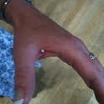 Beauty Spot - Hand Web piercing - Day Spas Near Me - Brighton, BNH