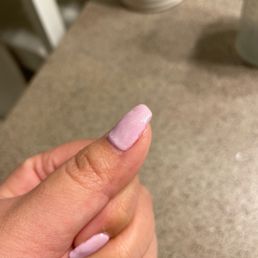 Bumpy, thick nail Bumpy, thick nail