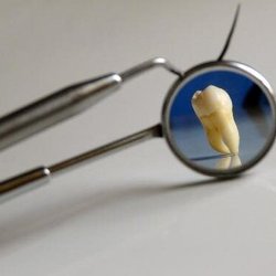 Share Dental Care - Dental Implants and Extractions