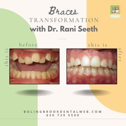 Bolingbrook Dental Care - #bolingbrookdentalcare #dentist