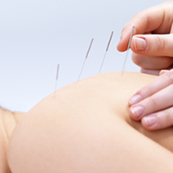 South Hill Acupuncture Clinic