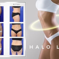 Farber Plastic Surgery - Scott Farber MD - One procedure that addresses the stomach, love handles, buttocks, and thighs.