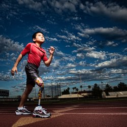 Artificial Limb Specialists