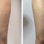 Photo of Tighten Body Bar